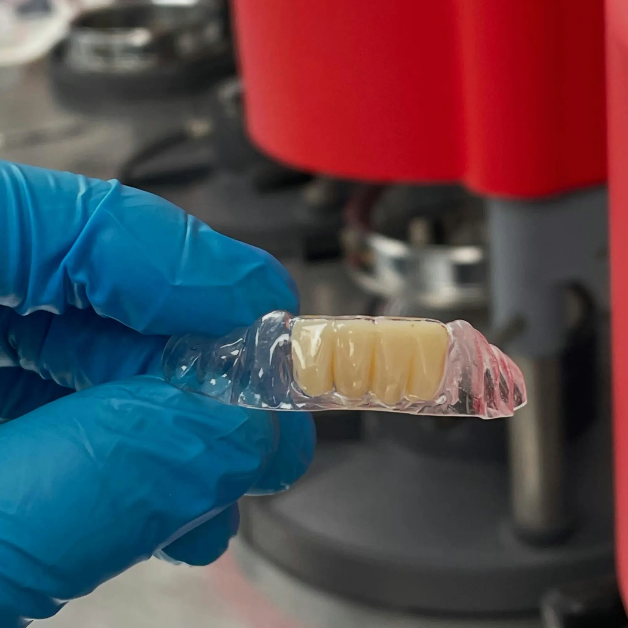 A clear retainer with a natural-looking pontic tooth, held in our lab