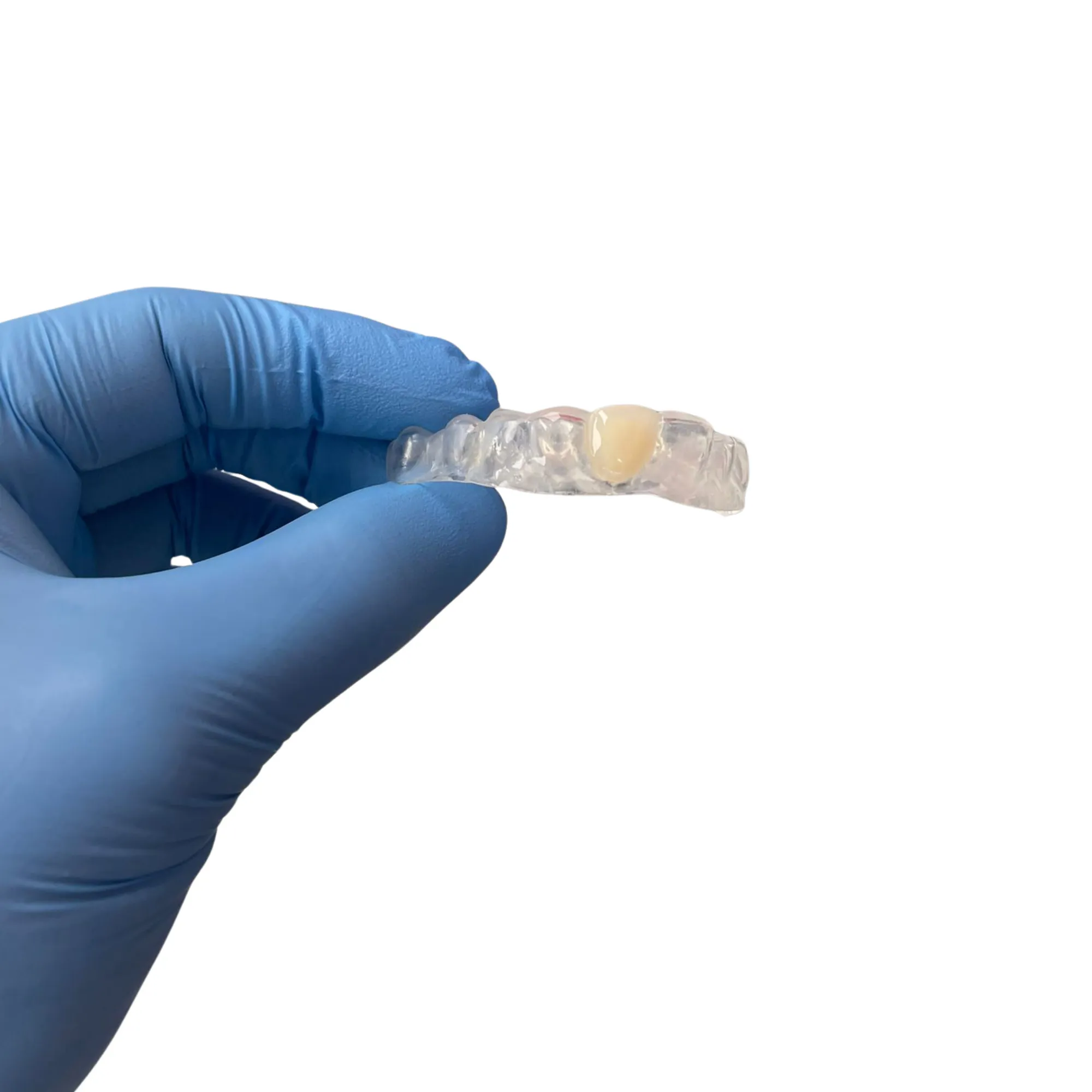 Retainer with pontic appliance
