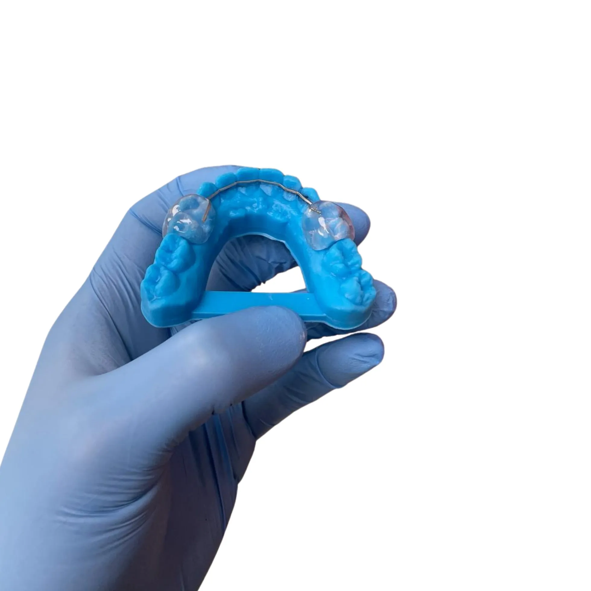 Fixed retainer appliance