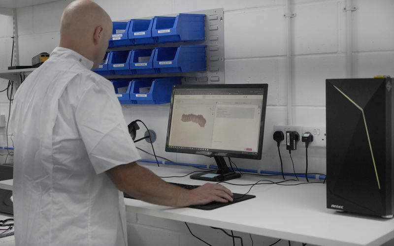 Digital impression software showing tooth model